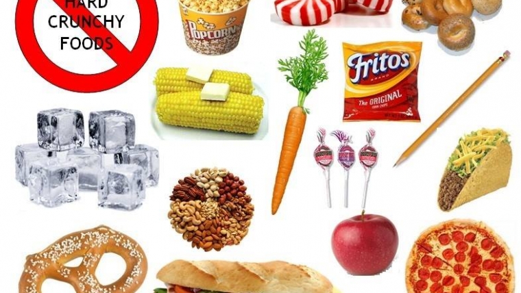 Alimente interzise si alimente permise pacientilor cu bracketuri