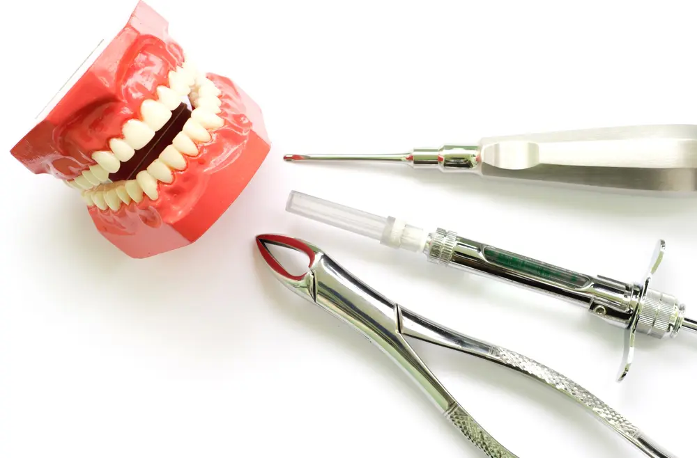 Asian Harmonious provoke Extractii dentare - Implant dentar - Aditia de os - Orto Implant Expert