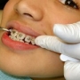 Aparate dentare pentru copii
