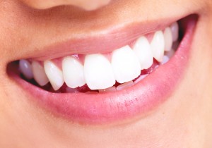 Viata fara bracketuri – dupa scoaterea aparatului dentar
